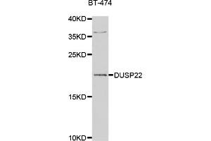 Western blot analysis of extracts of BT-474 cells, using DUSP22 antibody. (DUSP22 抗体)
