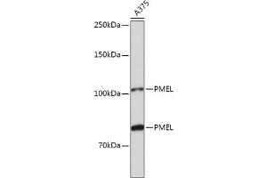 Western blot analysis of extracts of  cells, using PMEL antibody (ABIN7269510) at 1:1000 dilution. (Melanoma gp100 抗体  (AA 25-300))