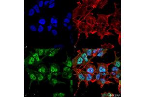 Immunocytochemistry/Immunofluorescence analysis using Mouse Anti-GABA-A Receptor Alpha2 Monoclonal Antibody, Clone S399-19 . (GABRA1 抗体  (AA 350-385))