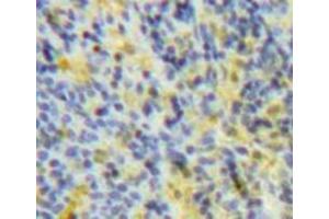 IHC-P analysis of Spleen tissue, with DAB staining. (SOCS3 抗体  (AA 1-225))
