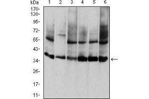 Western blot analysis using ANXA5 mouse mAb against HepG2 (1), PNAC-1 (2), NIH/3T3 (3), Hela (4), MCF-7 (5), and A431 (6) cell lysate. (Annexin V 抗体  (AA 160-320))