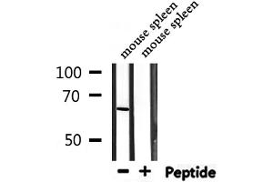 Western blot analysis of extracts from mouse spleen, using PTBP1 Antibody. (PTBP1 抗体  (N-Term))