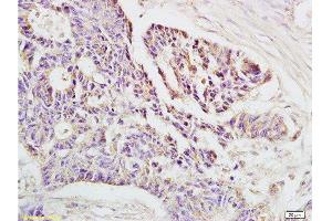Immunohistochemistry (Paraffin-embedded Sections) (IHC (p)) image for anti-HLA Class I Histocompatibility Antigen, alpha Chain E (HLA-E) (AA 251-358) antibody (ABIN674334)