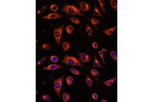 Immunofluorescence analysis of L929 cells using SC antibody (ABIN7270188) at dilution of 1:100. (SCAMP2 抗体  (AA 1-152))
