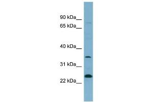 WB Suggested Anti-NOSIP  Antibody Titration: 0. (NOSIP 抗体  (N-Term))