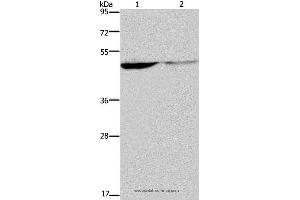 Western blot analysis of Human paraneoplastic and normal kidney tissue, using KCNK9 Polyclonal Antibody at dilution of 1:650 (KCNK9 抗体)