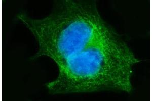 IF analysis of FGFR3 using anti-FGFR3 antibody (ABIN7603047). (FGFR3 抗体  (Middle Region))