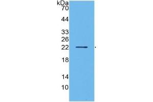 WB of Protein Standard: different control antibodies  against Highly purified E. (IL1A ELISA 试剂盒)