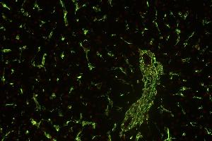 Immunohistochemistry staining (paraffin sections) of vimentin in human liver using mouse monoclonal antibody VI-01 ((ABIN94491), diluted 1:400), detected with GAM IgM-Alexa Fluor488 (diluted 1:200, green), cell nuclei stained with PI (1 μg/mL, orange). (Vimentin 抗体)