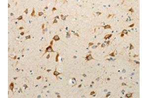 The image on the left is immunohistochemistry of paraffin-embedded Human brain tissue using ABIN7130917(RPAP3 Antibody) at dilution 1/15, on the right is treated with fusion protein. (RPAP3 抗体)