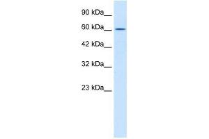 TRIM17 antibody used at 2. (TRIM17 / RNF16 抗体  (Middle Region))