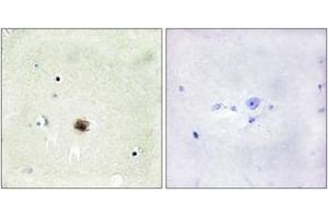 Immunohistochemistry analysis of paraffin-embedded human brain tissue, using CRP1 Antibody. (CSRP1 抗体  (AA 51-100))