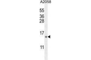 Western blot analysis in A2058 cell line lysates (35ug/lane) using MRPS24 Antibody .