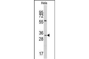Western blot analysis of anti-MAGEA1 Antibody in Hela cell line lysates (35ug/lane). (MAGEA1 抗体  (AA 143-173))