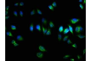 Immunofluorescence staining of Hela cells with  at 1:333, counter-stained with DAPI. (TNRC6A 抗体  (AA 1-161))