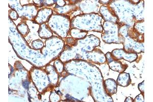 Formalin-fixed, paraffin-embedded human Placenta stained with CD71 Mouse Monoclonal Antibody (TFRC/1817). (Transferrin Receptor 抗体  (AA 94-212))