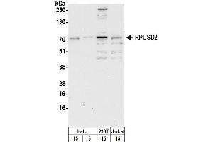 anti-RNA Pseudouridylate Synthase Domain Containing 2 (RPUSD2) (AA 75-125) antibody