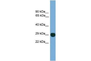 WB Suggested Anti-EIF4E2  Antibody Titration: 0. (EIF4E2 抗体  (N-Term))