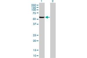 Western Blot analysis of GHDC expression in transfected 293T cell line by GHDC MaxPab polyclonal antibody. (GHDC 抗体  (AA 1-530))