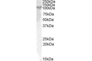 ABIN570920 (1µg/ml) staining of Rat Kidney lysate (35µg protein in RIPA buffer). (IL17RA 抗体  (Internal Region))