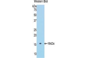 Western blot analysis of the recombinant protein. (COL6A1 抗体  (AA 82-212))