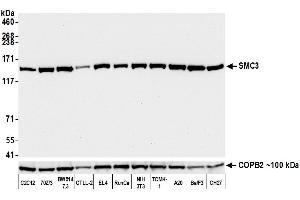 Western Blotting (WB) image for anti-Structural Maintenance of Chromosomes 3 (SMC3) (AA 1175-1217) antibody (ABIN7453329)