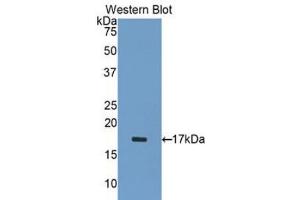 Western blot analysis of the recombinant protein. (ADAMTS1 抗体  (AA 476-614))