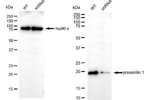 Western blotting analysis using presenilin 1 antibody (ABIN7799897). (Recombinant Presenilin 1 抗体)