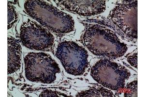 Immunohistochemistry (IHC) image for anti-Ectonucleotide pyrophosphatase/phosphodiesterase 3 (ENPP3) (Internal Region) antibody (ABIN3187797)