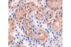 Used in DAB staining on fromalin fixed paraffin- embedded Kidney tissue (DGKG 抗体  (AA 346-576))