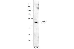 Lane 1:Rat brain lysates probed with Rabbit Anti-KCNK3 Polyclonal Antibody, Unconjugated  at 1:3000 for 90 min at 37˚C. (KCNK3 抗体  (AA 181-280))