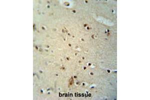 Immunohistochemistry (Paraffin-embedded Sections) (IHC (p)) image for anti-Capicua Homolog (CIC) (AA 177-207), (N-Term) antibody (ABIN951529)
