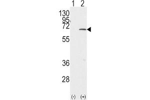 Western Blotting (WB) image for anti-Protein Inhibitor of Activated STAT, 1 (PIAS1) antibody (ABIN2996746) (PIAS1 抗体)