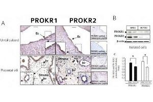 PROKR1 and PROKR2 protein expression in placental-tissue umbilical cord and in isolated HPECs and HUVECs (A) Immunohistochemistry of chorionic villi and ombilical cord sections using antibodies to PROKR1 and PROKR2. (Prokineticin Receptor 1 抗体  (N-Term))
