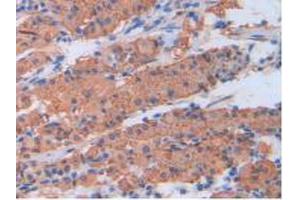 IHC-P analysis of Human Stomach Tissue, with DAB staining. (CRP 抗体  (AA 17-224))