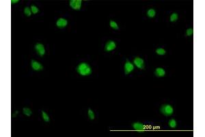 Image no. 4 for anti-V-Akt Murine Thymoma Viral Oncogene Homolog 1 (AKT1) (AA 1-481) antibody (ABIN598531) (AKT1 抗体  (AA 1-481))