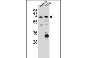 CES8 Antibody (C-term) (ABIN656888 and ABIN2846087) western blot analysis in Sk-Br-3,T47D cell line lysates (35 μg/lane). (CES4A 抗体  (C-Term))
