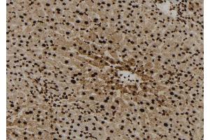 ABIN6272959 at 1/100 staining Mouse liver tissue by IHC-P. (FABP5 抗体  (Internal Region))