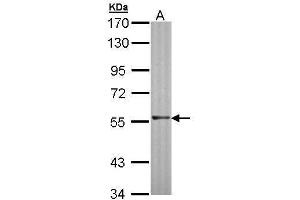 WB Image Sample (30 ug of whole cell lysate) A: Molt-4 , 7. (RAG2 抗体  (Center))
