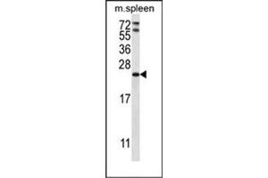 Western Blotting (WB) image for anti-RAP1A, Member of RAS Oncogene Family (RAP1A) (AA 141-170), (C-Term) antibody (ABIN954451)