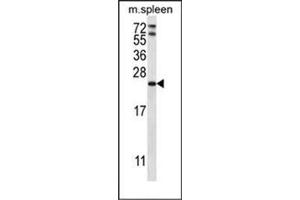 Western blot analysis of RAP1A Antibody (C-term) in mouse spleen tissue lysates (35ug/lane).