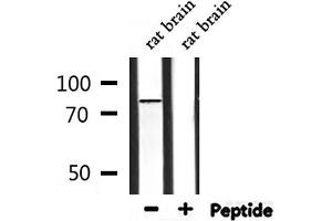 Western Blotting (WB) image for anti-Hydroxyacyl-Coenzyme A Dehydrogenase/3-Ketoacyl-Coenzyme A Thiolase/enoyl-Coenzyme A Hydratase (Trifunctional Protein), alpha Subunit (HADHA) (C-Term) antibody (ABIN6262145)