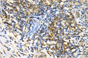 anti-Staufen Double-Stranded RNA Binding Protein 1 (STAU1) antibody