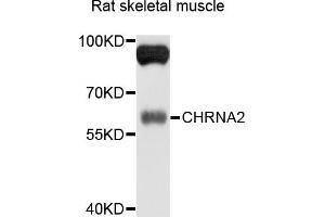 Western blot analysis of extracts of rat skeletal muscle, using CHRNA2 antibody (ABIN4903282) at 1:1000 dilution.