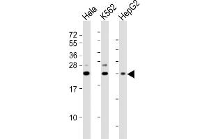 All lanes : Anti-SRY Antibody (N-Term) at 1:2000 dilution Lane 1: Hela whole cell lysates Lane 2: K562 whole cell lysates Lane 3: HepG2 whole cell lysates Lysates/proteins at 20 μg per lane. (SRY 抗体  (AA 52-82))