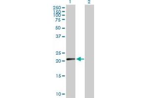 Western Blot analysis of N6AMT1 expression in transfected 293T cell line by N6AMT1 MaxPab polyclonal antibody. (N6AMT1 抗体  (AA 1-186))