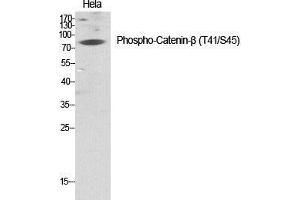 Western Blot (WB) analysis of specific cells using Phospho-Catenin-beta (T41/S45) Polyclonal Antibody. (beta Catenin 抗体  (pSer45, pThr41))