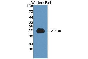 Detection of Recombinant ITGb8, Human using Polyclonal Antibody to Integrin Beta 8 (ITGb8) (ITGB8 抗体  (AA 471-629))
