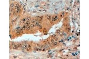 AP23772PU-N SEMA3E antibody staining of Paraffin Embedded Human Prostate at 4 µg/ml. (SEMA3E 抗体  (Internal Region))