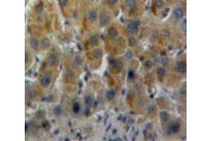 Used in DAB staining on fromalin fixed paraffin-embedded Liver tissue